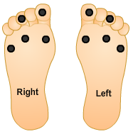William's feet with monofilament sites