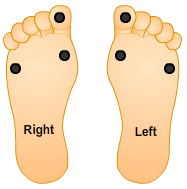 William's feet with monofilament sites